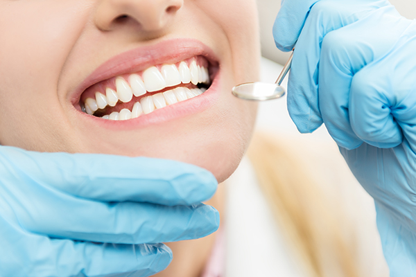 Benefits of Air Abrasion