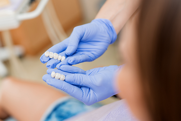 What Are Dental Bridges?
