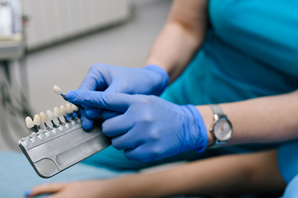 What Are Porcelain Veneers?