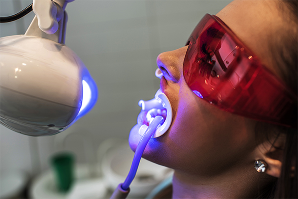 Is Teeth Whitening Right for You?